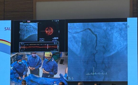 El Dr. Jorge Palazuelos, Co-Director del IV Curso de Tratamiento de Placas Calcificadas y/o Complejas celebrado en Salamanca El Dr. Jorge Palazuelos, Co-Director del IV Curso de Tratamiento de Placas Calcificadas y/o Complejas celebrado en Salamanca