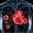 Prevención de la endocarditis infecciosa: lo que todos deberíamos saber